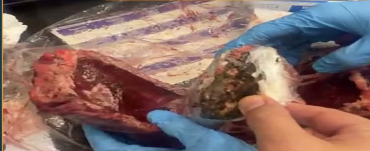 ضبط سيدة بمطار القاهرة بحوزتها مخدر الحشيش مخبأ داخل لحوم مجمدة